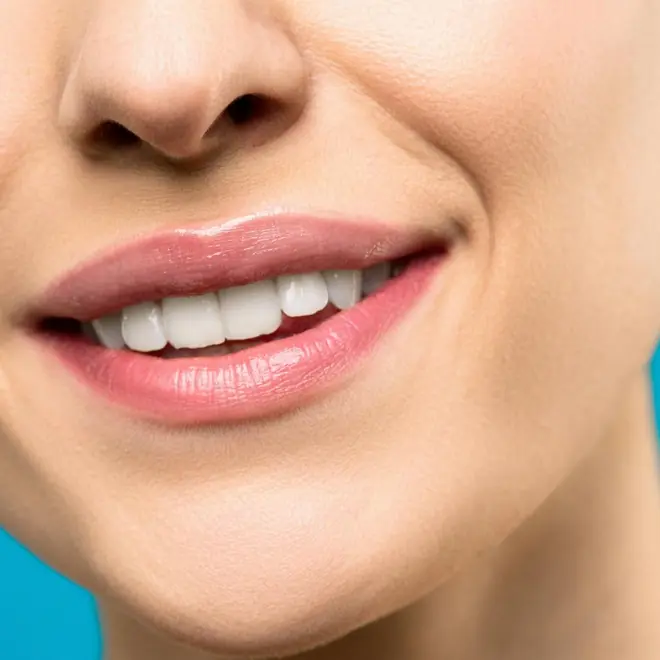 Antes y después de blanqueamiento dental profesional