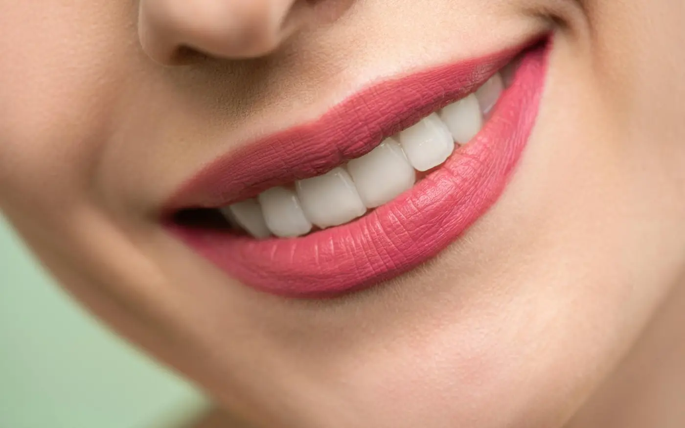 Después: Antes y después de colocación de carillas dentales